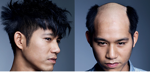 Tout savoir en matière de complément capillaire 